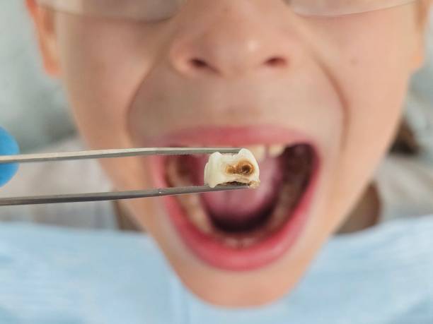 Best Emergency Dental Surgery in Waterville, NY